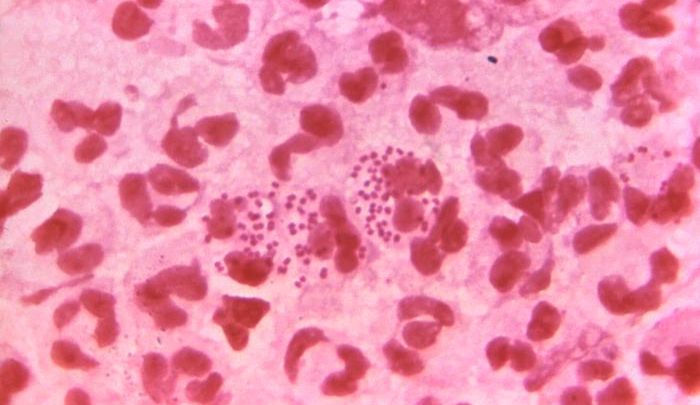 Le CBD peut tuer les bactéries de la gonorrhée: étude de l’Université du Queensland