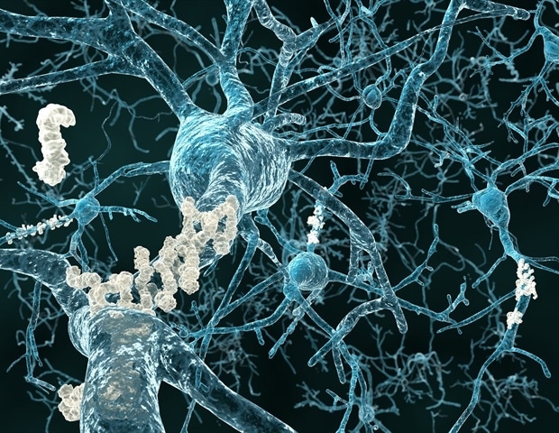 Le CBD améliore la fonction cognitive dans un modèle expérimental de la maladie d’Alzheimer familiale