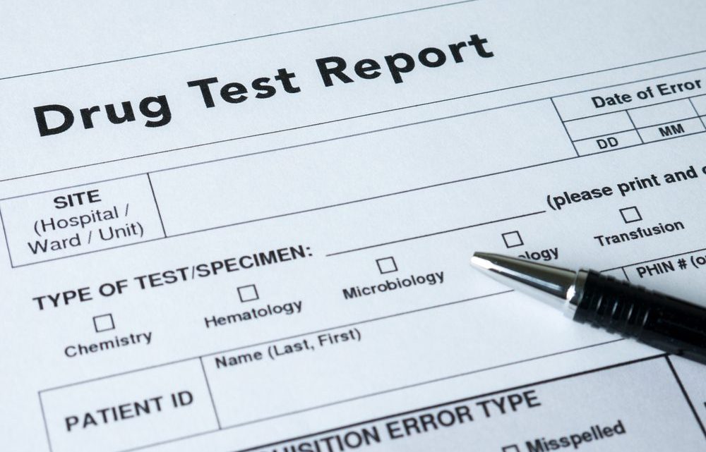 Pouvez-vous échouer à un test de dépistage de drogue après avoir pris du THC-O ?